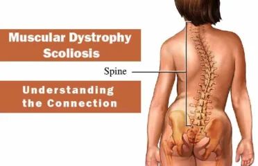 blog-grid-1-410x308